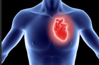 10 самых распространенных причин инфаркта и инсульта-1
